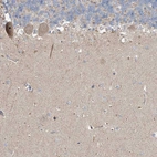 Immunohistochemical staining of human cerebellum shows moderate cytoplasmic-nucleoli positivity in Purkinje cells.