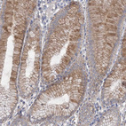 Immunohistochemical staining of human stomach shows moderate cytoplasmic-nucleoli positivity in glandular cells.