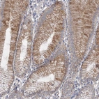 Immunohistochemical staining of human stomach shows moderate cytoplasmic-nucleoli positivity in glandular cells.