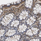 Immunohistochemical staining of human colon shows moderate cytoplasmic/nucleus positivity in glandular cells.