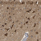 Immunohistochemical staining of human cerebral cortex shows moderate cytoplasmic positivity in neuronal cells.