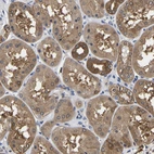 Immunohistochemical staining of human kidney shows moderate cytoplasmic positivity in cells in tubules.