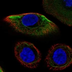 Immunofluorescent staining of human cell line hTCEpi shows localization to intermediate filaments.