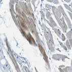 Immunohistochemical staining of human skeletal muscle shows moderate cytoplasmic positivity in myocytes.