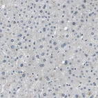 Immunohistochemical staining of human liver shows no positivity in hepatocytes.