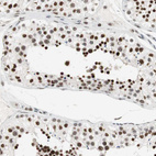 Immunohistochemical staining of human testis shows strong nuclear positivity in cells in seminiferous ducts.