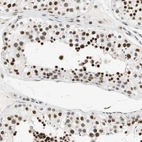 Immunohistochemical staining of human testis shows strong nuclear positivity in cells in seminiferous ducts.
