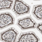 Immunohistochemical staining of human small intestine shows strong nuclear positivity in glandular cells and lymphoid cells.