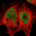 Immunofluorescent staining of human cell line A-431 shows localization to nucleus & cytosol.