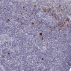 Immunohistochemical staining of human lymphoid tissues shows strong cytoplasmic positivity in squamous epithelial cells.