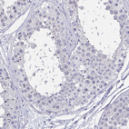 Immunohistochemical staining of human testis shows negative positivity in cells in seminiferous ducts.
