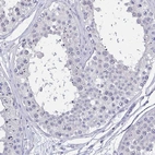 Immunohistochemical staining of human testis shows negative positivity in cells in seminiferous ducts.