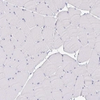 Immunohistochemical staining of human skeletal muscle shows negative positivity in myocytes.