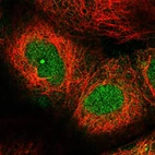 Immunofluorescent staining of human cell line A-431 shows localization to nucleus & cytosol.
