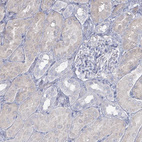 Immunohistochemical staining of human kidney shows weak cytoplasmic positivity in cells in tubules.