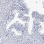 Immunohistochemical staining of human prostate shows negative positivity in glandular cells.