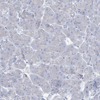 Immunohistochemical staining of human pancreas shows very weak cytoplasmic positivity in exocrine glandular cells.