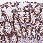 Immunohistochemical staining of human colon shows moderate cytoplasmic positivity in glandular cells.