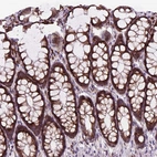 Immunohistochemical staining of human colon shows moderate cytoplasmic positivity in glandular cells.
