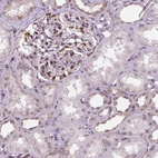 Immunohistochemical staining of human kidney shows strong cytoplasmic positivity in cells in glomeruli.
