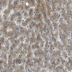 Immunohistochemical staining of human liver shows moderate cytoplasmic positivity in hepatocytes.