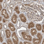Immunohistochemical staining of human kidney shows moderate cytoplasmic-membranous positivity in cells in tubules in addition to nucleus positivity in subset of cells.