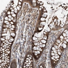 Immunohistochemical staining of human colon shows moderate cytoplasmic positivity in glandular cells.