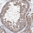 Immunohistochemical staining of human testis shows moderate cytoplasmic positivity in cells in seminiferous ducts and Leydig cells.