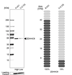 Western blot analysis in human cell lines A-431 and U2OS using Anti-ZDHHC9 antibody. Corresponding ZDHHC9 RNA-seq data are presented for the same cell lines. Loading control: Anti-PFN1.