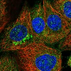Immunofluorescent staining of human cell line A-431 shows localization to cytosol & the Golgi apparatus.