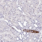 Immunohistochemical staining of human kidney shows strong cytoplasmic positivity in endothelial cells.