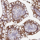 Immunohistochemical staining of human small intestine shows strong cytoplasmic-membranous positivity in glandular cells.
