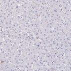 Immunohistochemical staining of human liver shows no positivity in hepatocytes.