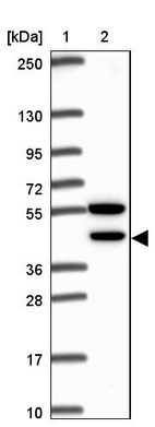 Lane 1: Marker [kDa] 250, 130, 95, 72, 55, 36, 28, 17, 10_br/_Lane 2: Human cell line RT-4