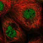 Immunofluorescent staining of human cell line A-431 shows localization to nucleoplasm & vesicles.