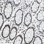 Immunohistochemical staining of human rectum shows strong nuclear positivity in glandular cells.
