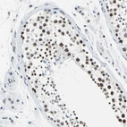 Immunohistochemical staining of human testis shows moderate nuclear positivity in cells in seminiferous ducts.