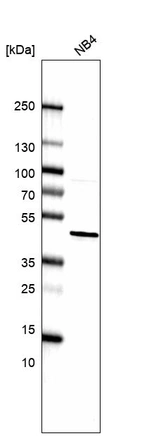 Western blot analysis in human cell line NB4.