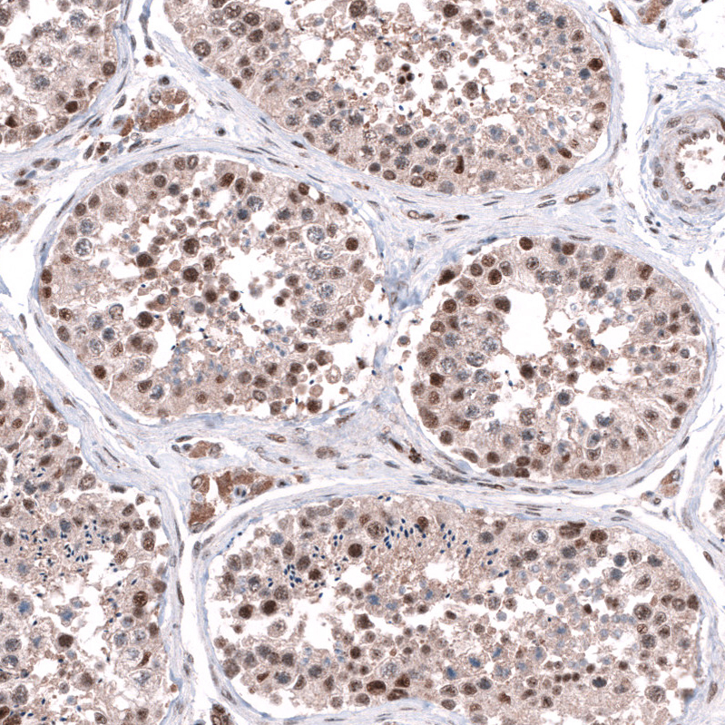 Anti-C20orf196 Antibody