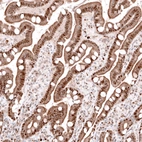 Immunohistochemical staining of human duodenum shows moderate to strong nuclear positivity in glandular cells.