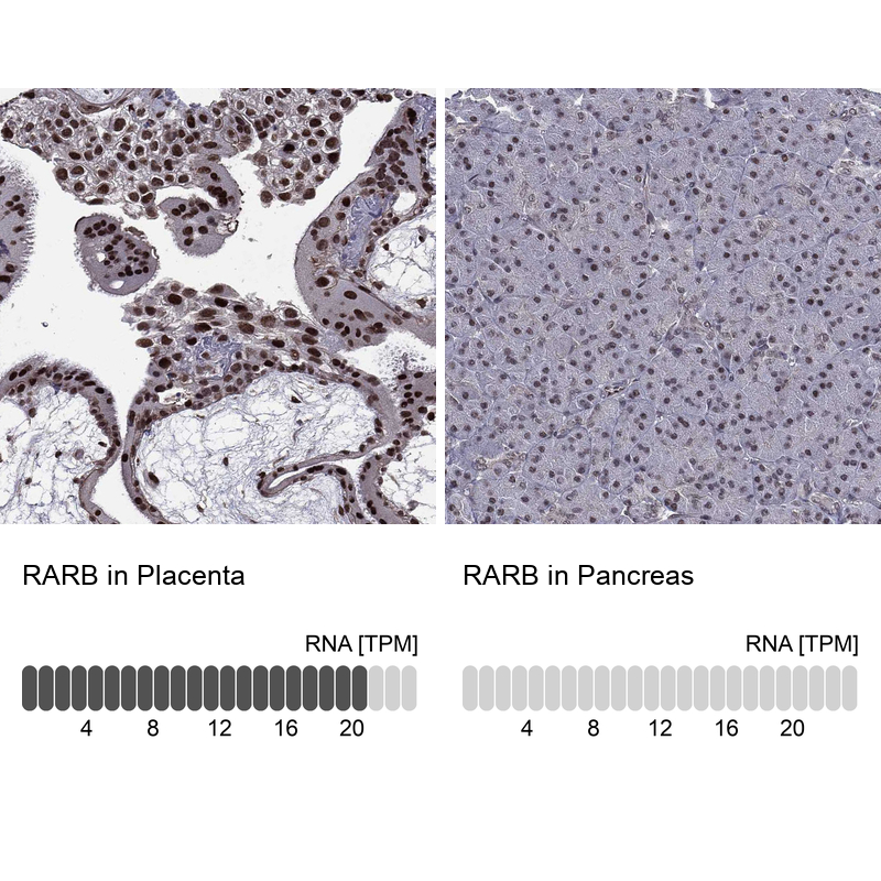 Anti-RARB Antibody