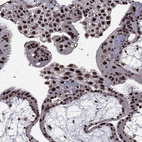 Immunohistochemical staining of human placenta shows strong nuclear positivity in trophoblastic cells.