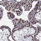 Immunohistochemical staining of human placenta shows strong nuclear positivity in trophoblastic cells.