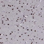 Immunohistochemical staining of human cerebral cortex shows strong nuclear positivity in neurons.