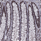 Immunohistochemical staining of human rectum shows strong nuclear positivity in glandular cells.