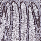Immunohistochemical staining of human rectum shows strong nuclear positivity in glandular cells.