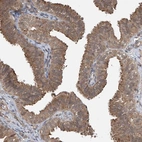 Immunohistochemical staining of human fallopian tube shows moderate cytoplasmic positivity in glandular cells and ciliated cells.