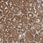 Immunohistochemical staining of human kidney shows strong nuclear positivity in cells in tubules with cytoplasmic positivity.