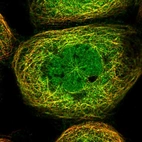 Immunofluorescent staining of human cell line A-431 shows localization to nucleoplasm & microtubules.
