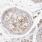 Immunohistochemical staining of human testis shows moderate cytoplasmic positivity in cells in seminiferous ducts.